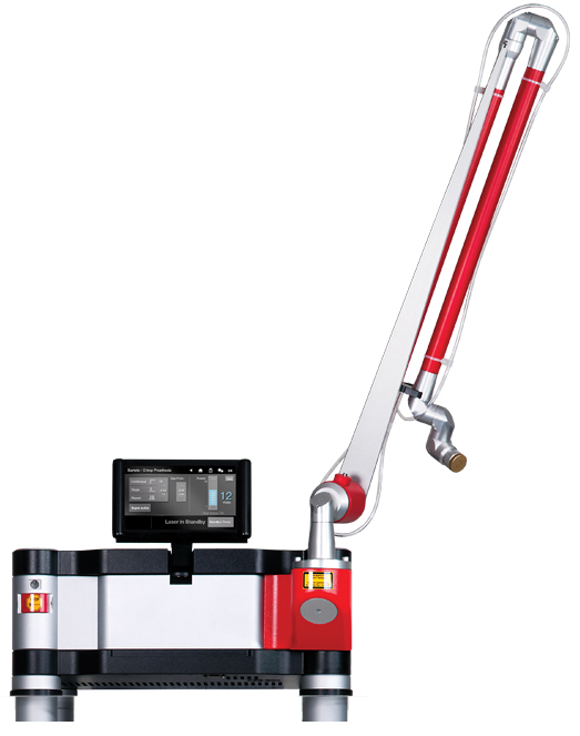 Intelliguide Laser System