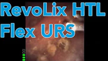 Flex URS – RevoLix HTL with Voiceover